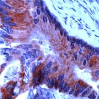 RARB Antibody in Immunohistochemistry (IHC)
