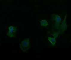 RARRES1 Antibody in Immunocytochemistry (ICC/IF)