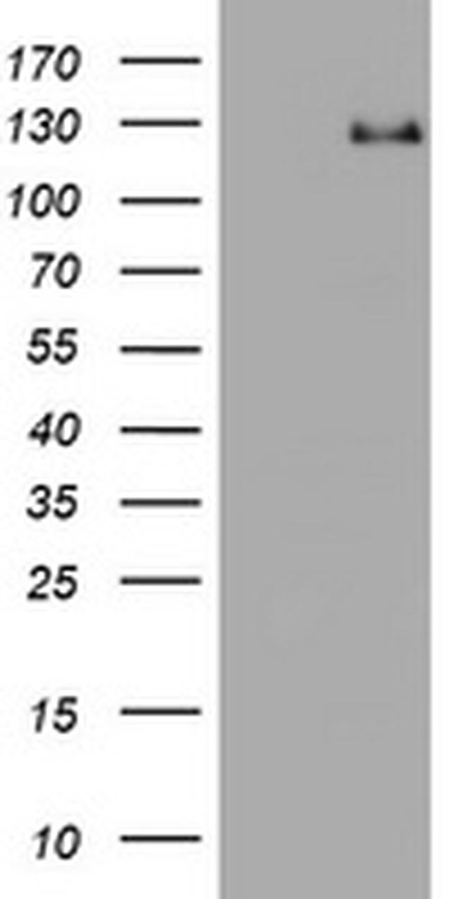 RASA1 Antibody in Western Blot (WB)