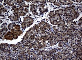 RASGRP3 Antibody in Immunohistochemistry (Paraffin) (IHC (P))