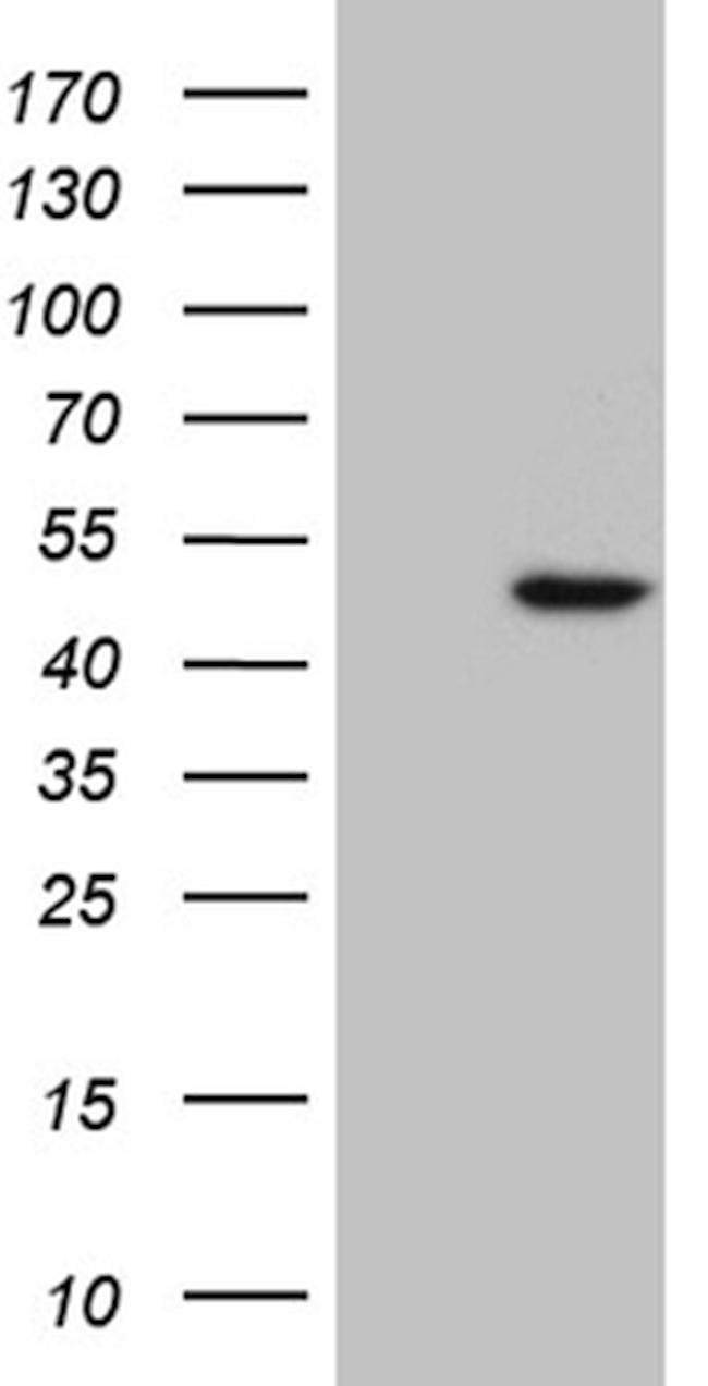 RAX Antibody in Western Blot (WB)