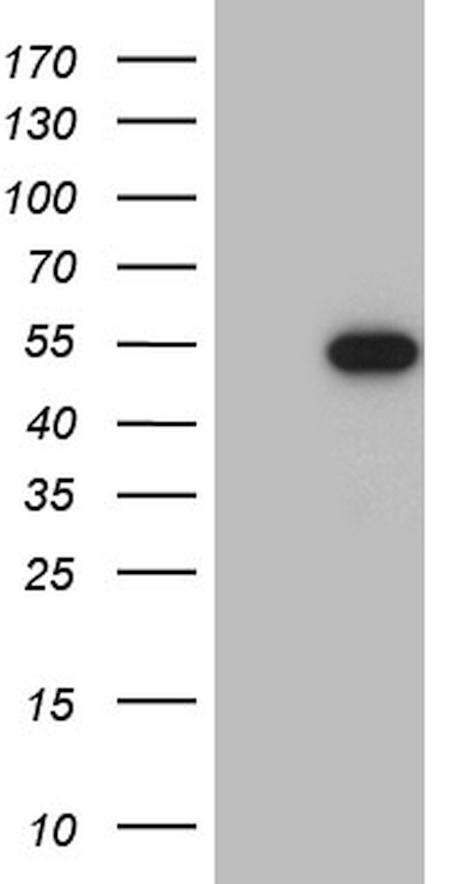 RAX Antibody in Western Blot (WB)