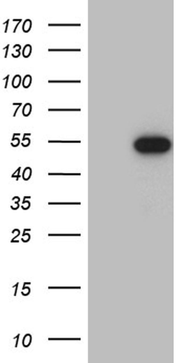 RAX Antibody in Western Blot (WB)