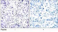 Rb Antibody in Immunohistochemistry (IHC)