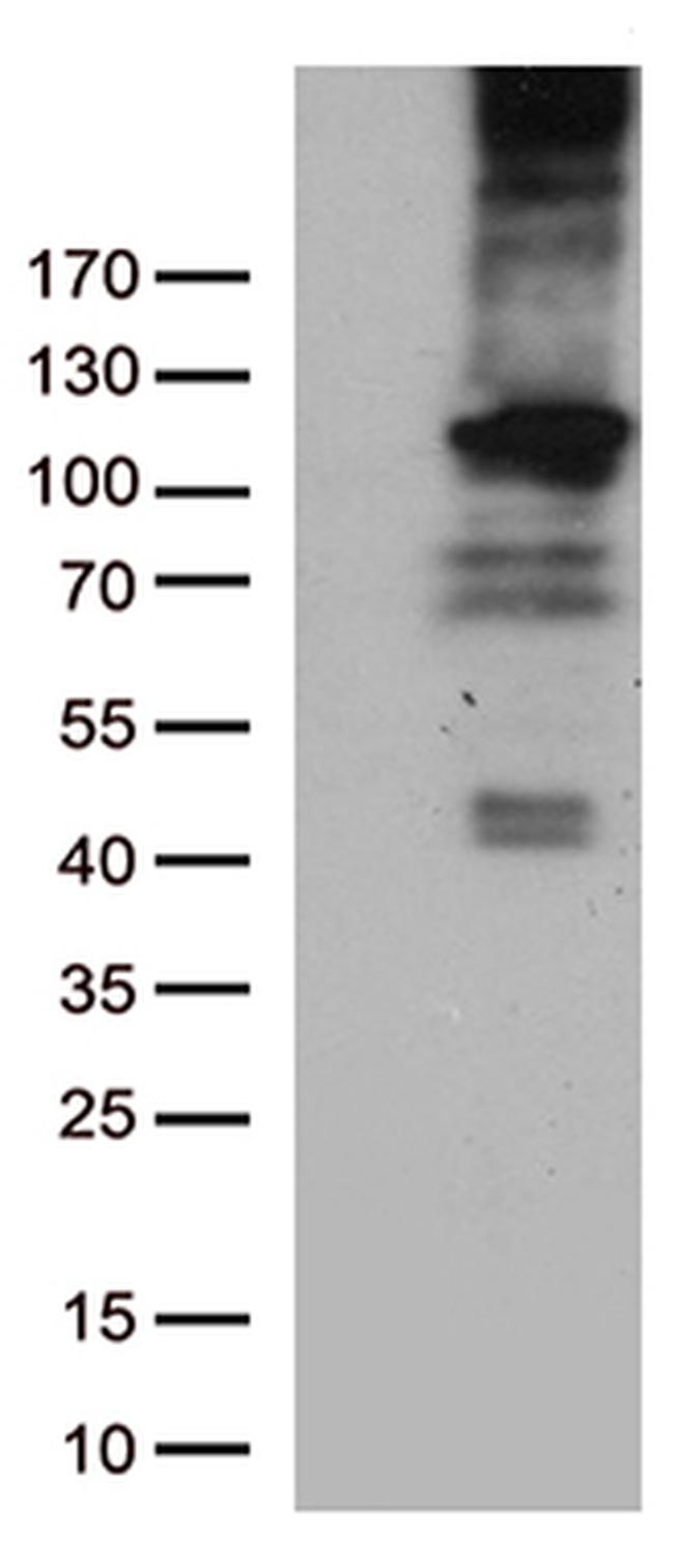 RB1 Antibody in Western Blot (WB)
