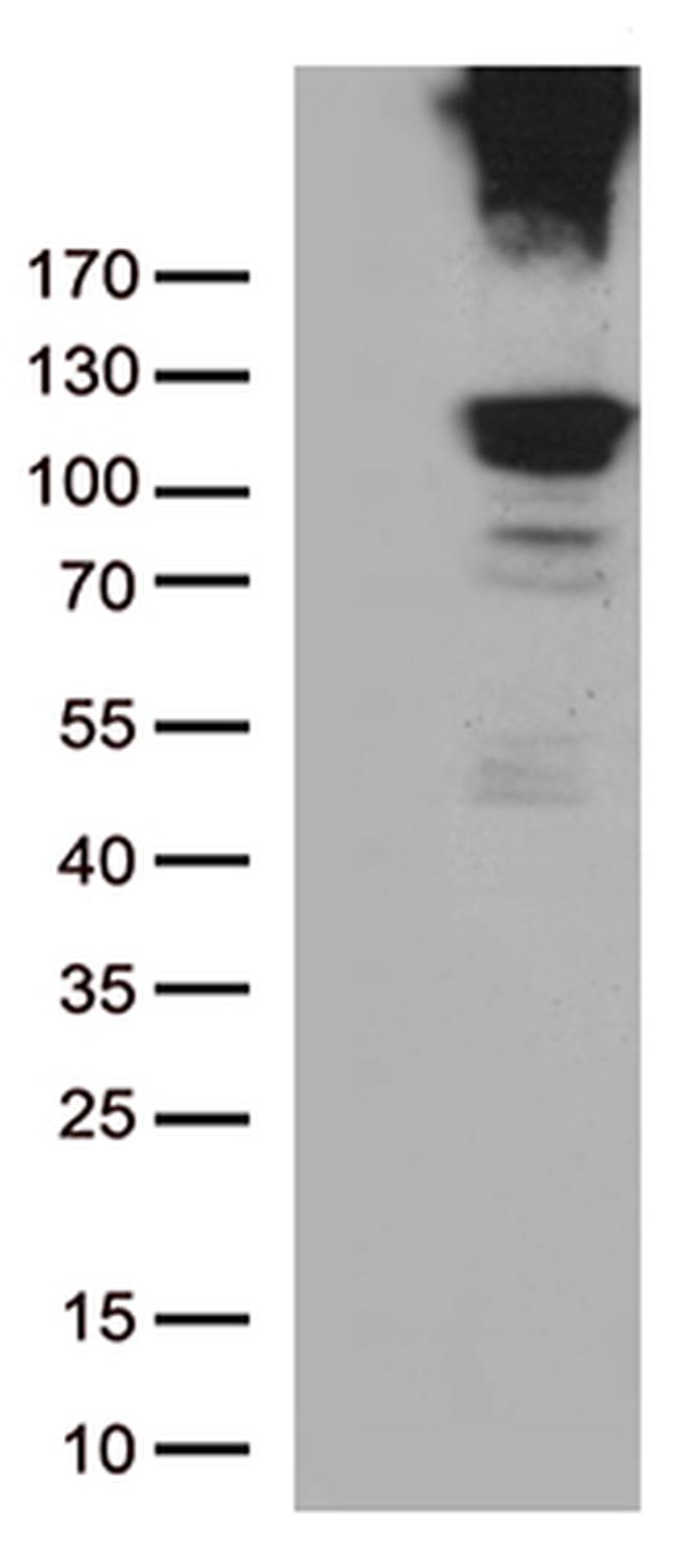 RB1 Antibody in Western Blot (WB)