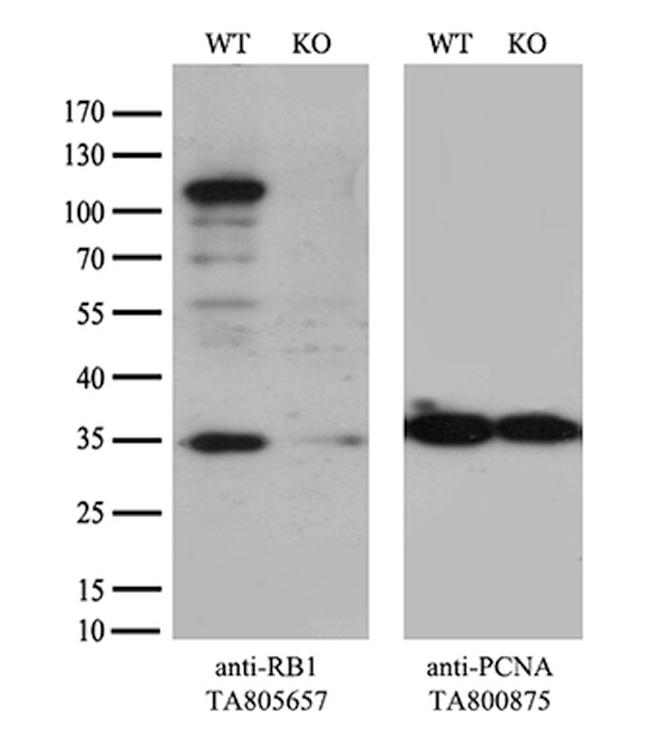 RB1 Antibody in Western Blot (WB)