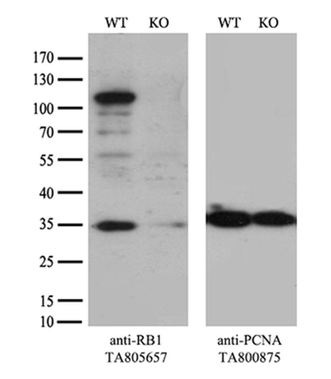 RB1 Antibody in Western Blot (WB)