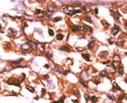 RBKS Antibody in Immunohistochemistry (IHC)