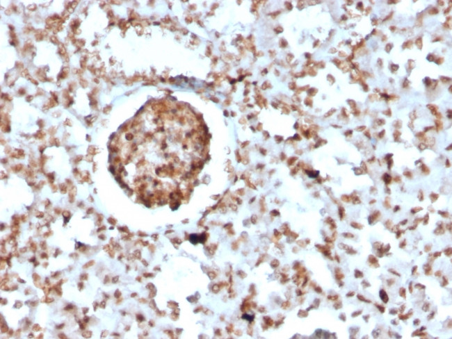 Bromodeoxyuridine (BrdU) Antibody in Immunohistochemistry (Paraffin) (IHC (P))