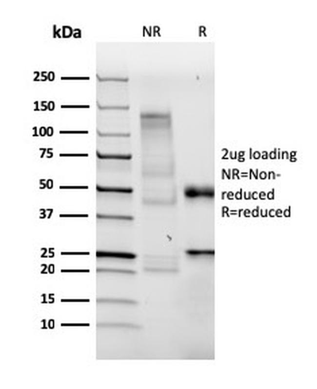 Bromodeoxyuridine (BrdU) Antibody in SDS-PAGE (SDS-PAGE)