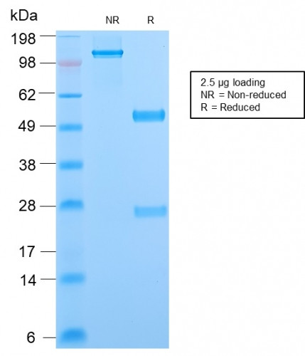 Phosphotyrosine (P-Tyr) Antibody in SDS-PAGE (SDS-PAGE)