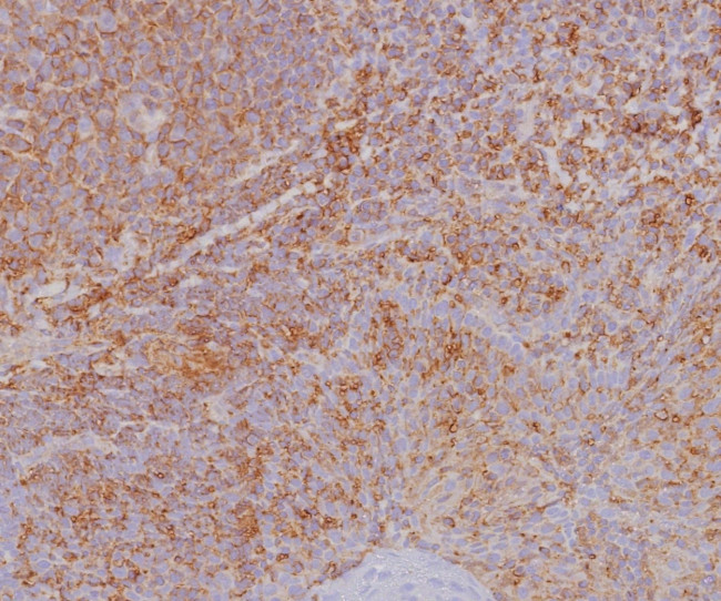HLA Class 1 ABC (MHC I) Antibody in Immunohistochemistry (Paraffin) (IHC (P))