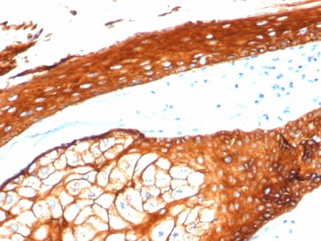 Cytokeratin, Type II (Epithelial Marker) Antibody in Immunohistochemistry (Paraffin) (IHC (P))