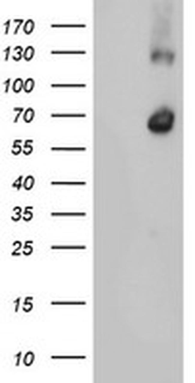 RBM46 Antibody in Western Blot (WB)