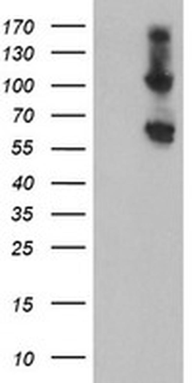 RBM46 Antibody in Western Blot (WB)