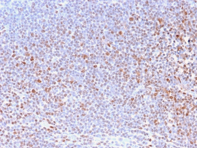 Nuclear Antigen Antibody in Immunohistochemistry (Paraffin) (IHC (P))