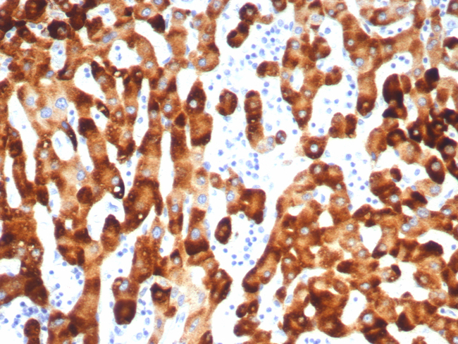 HBsAg (Hepatitis B surface Ag a determinant) Antibody in Immunohistochemistry (Paraffin) (IHC (P))