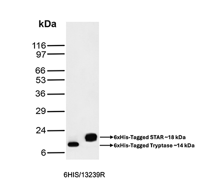 Hexa-histidine (Epitope Tag) Antibody in Western Blot (WB)