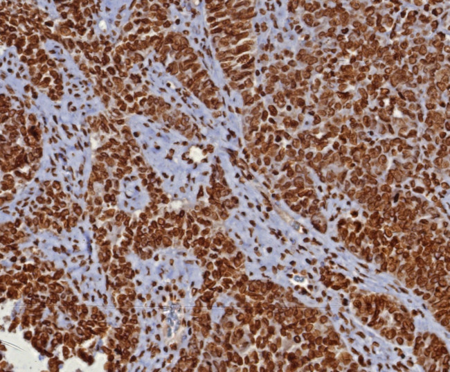 Double Stranded DNA (dsDNA) (Nuclear Marker) Antibody in Immunohistochemistry (Paraffin) (IHC (P))