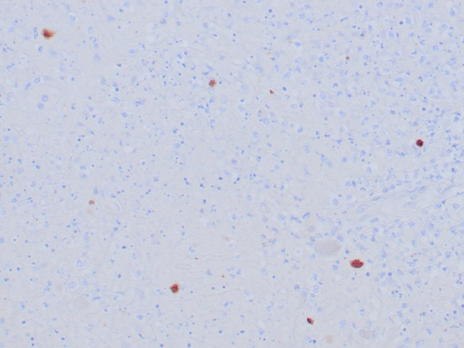 HSV1 (Herpes Simplex Virus Type I) Antibody in Immunohistochemistry (Paraffin) (IHC (P))