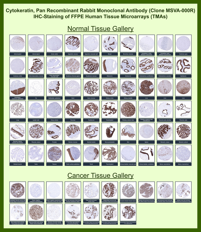 Cytokeratin, pan (Epithelial Marker) Antibody in Immunohistochemistry (Paraffin) (IHC (P))