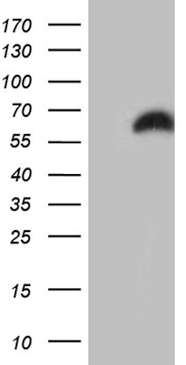 RBMS3 Antibody in Western Blot (WB)