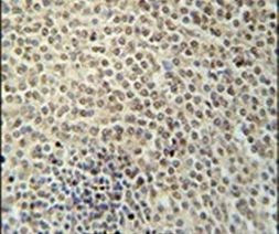 RBMX2 Antibody in Immunohistochemistry (IHC)