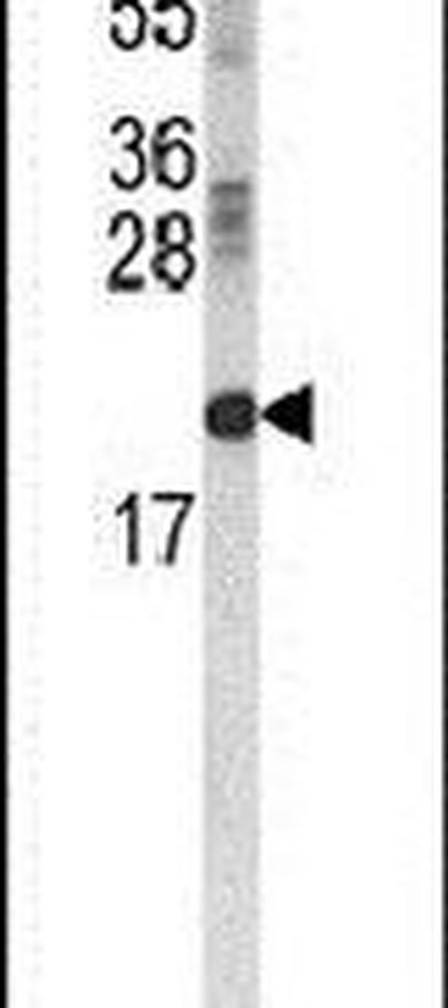 RBP2 Antibody in Western Blot (WB)