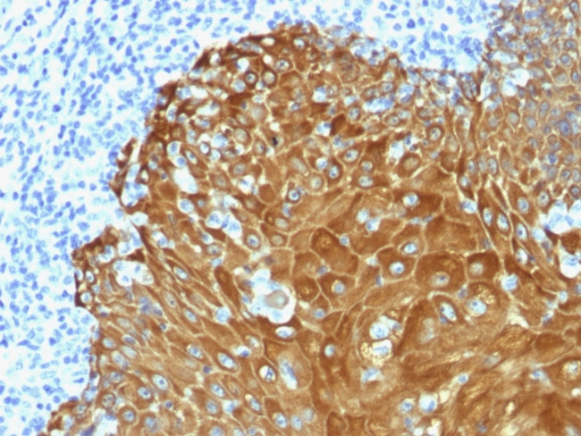 Cytokeratin, pan (Epithelial Marker) Antibody in Immunohistochemistry (Paraffin) (IHC (P))