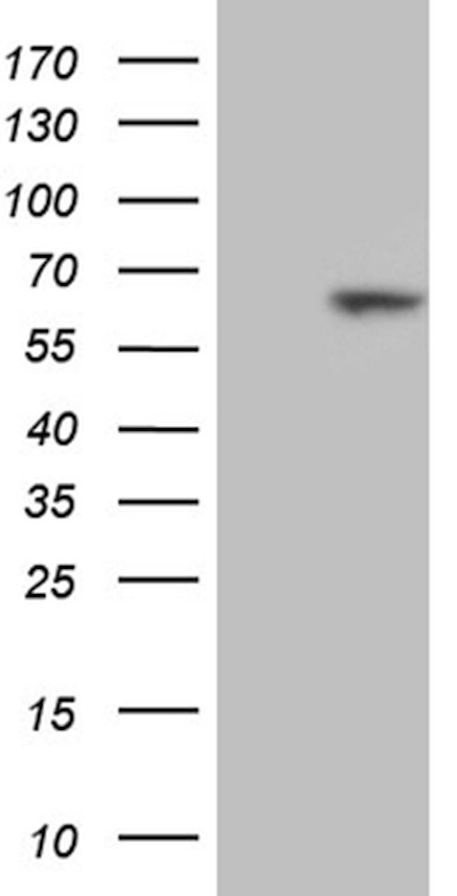 RBPJ Antibody in Western Blot (WB)