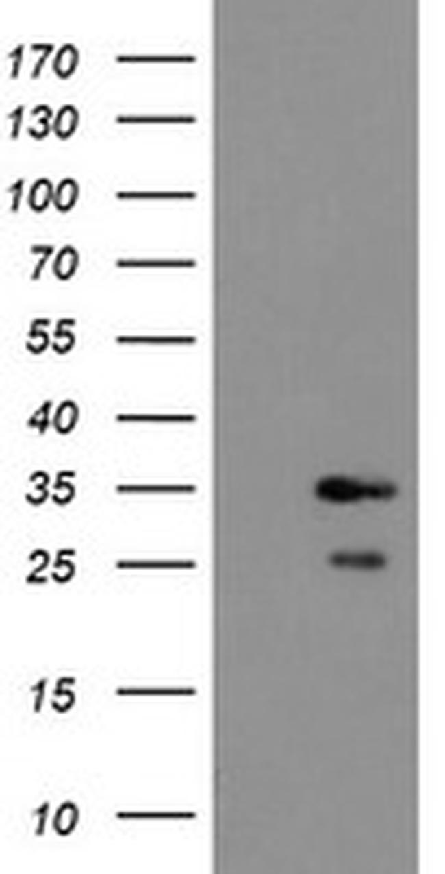 RBPMS Antibody in Western Blot (WB)