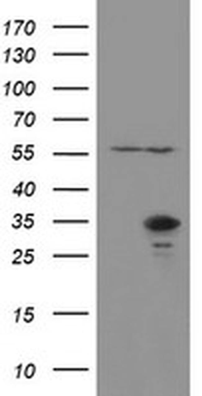 RBPMS Antibody in Western Blot (WB)