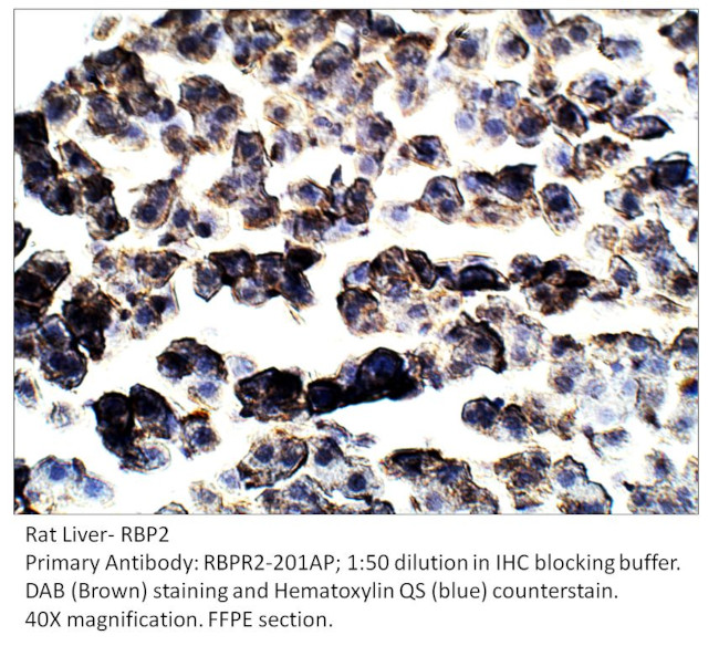 RBP2 Antibody in Immunohistochemistry (IHC)