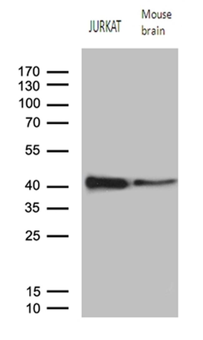 RCAN1 Antibody in Western Blot (WB)