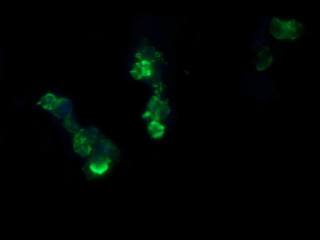 RCAN3 Antibody in Immunocytochemistry (ICC/IF)