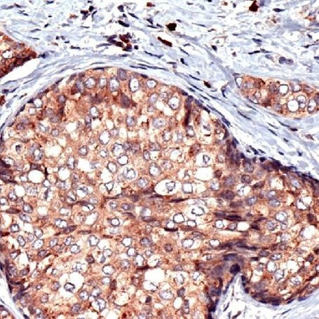RCAS1 Antibody in Immunohistochemistry (IHC)