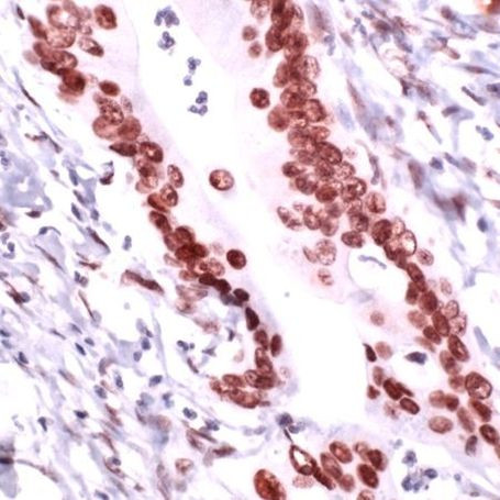 RCC1 Antibody in Immunohistochemistry (IHC)