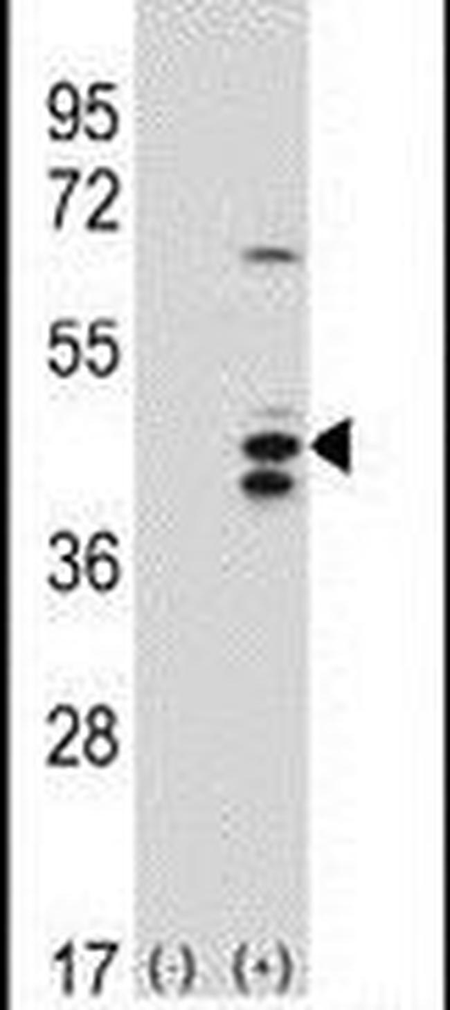 RCL1 Antibody in Western Blot (WB)