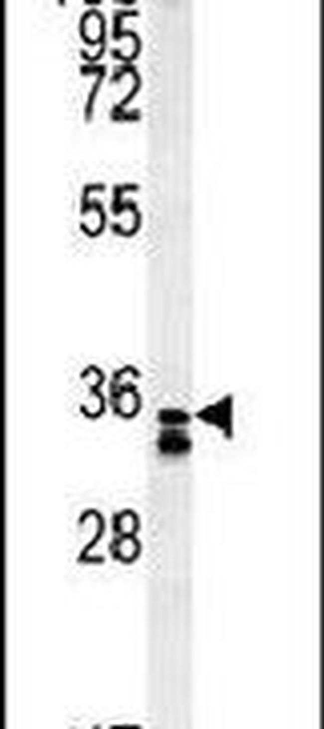 RCN3 Antibody in Western Blot (WB)