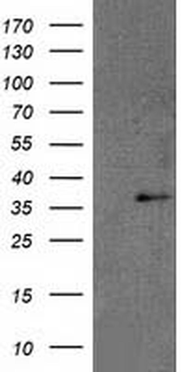 RDH14 Antibody in Western Blot (WB)