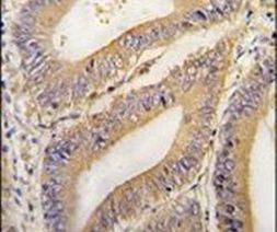 REA Antibody in Immunohistochemistry (IHC)