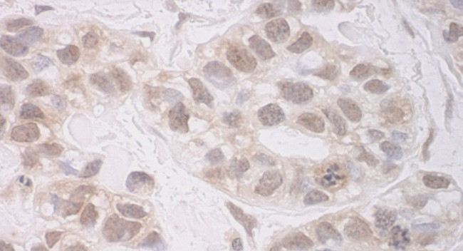 RECQ5 Antibody in Immunohistochemistry (IHC)