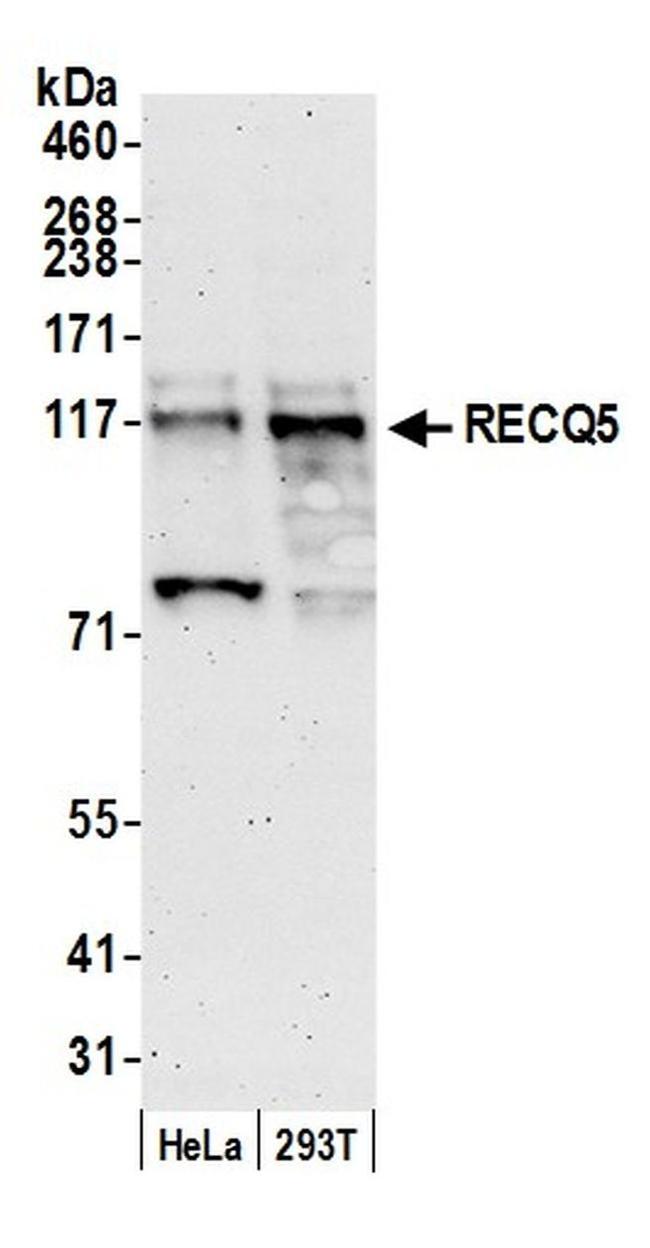 RECQ5 Antibody in Western Blot (WB)