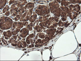 REEP5 Antibody in Immunohistochemistry (Paraffin) (IHC (P))