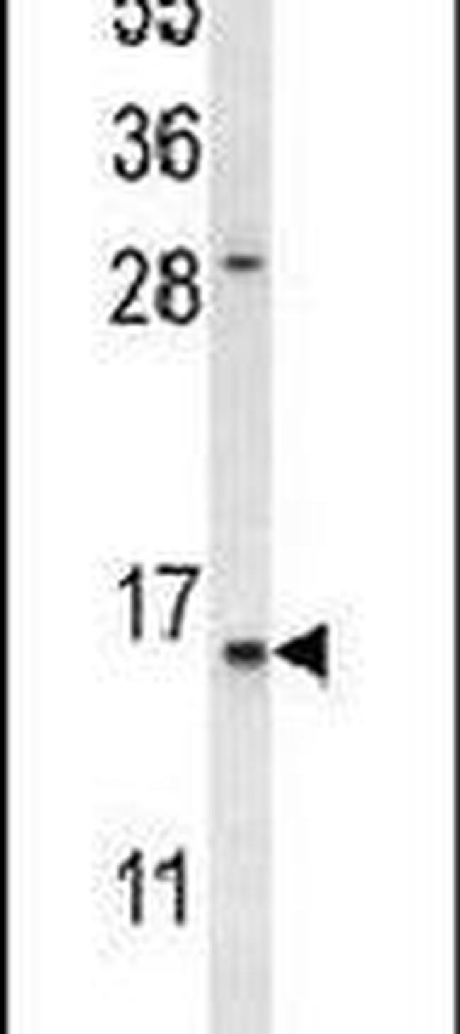 REG3A Antibody in Western Blot (WB)