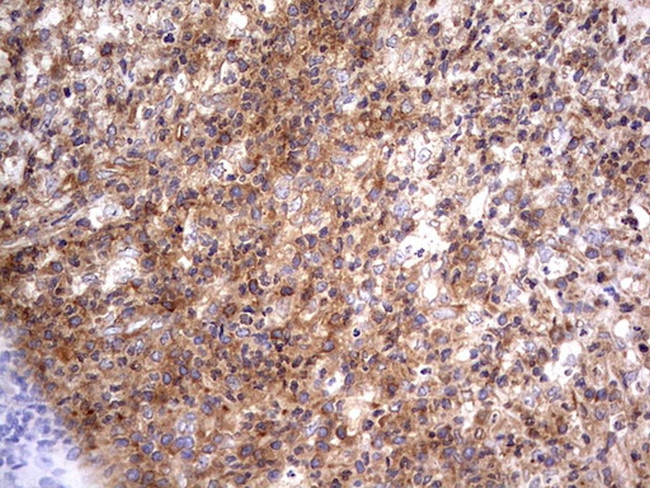 RELA Antibody in Immunohistochemistry (Paraffin) (IHC (P))