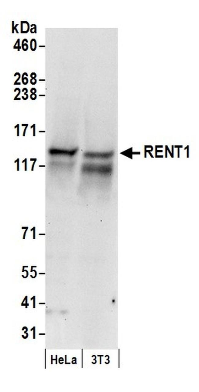 RENT1 Antibody in Western Blot (WB)