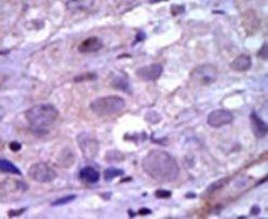 RET Antibody in Immunohistochemistry (IHC)
