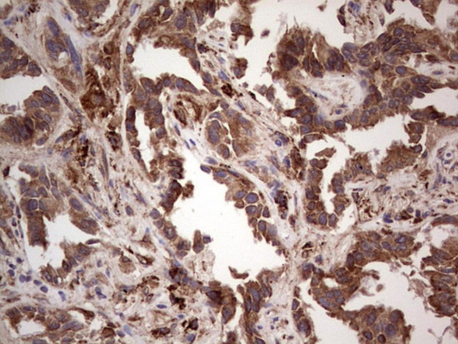 RET Antibody in Immunohistochemistry (Paraffin) (IHC (P))